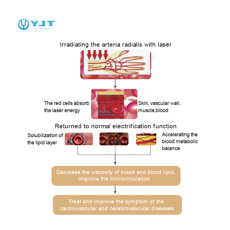 YJT OEM ODM Smart Watch Hot Sa - огляд і ціна Smartwatch Watches For Sale